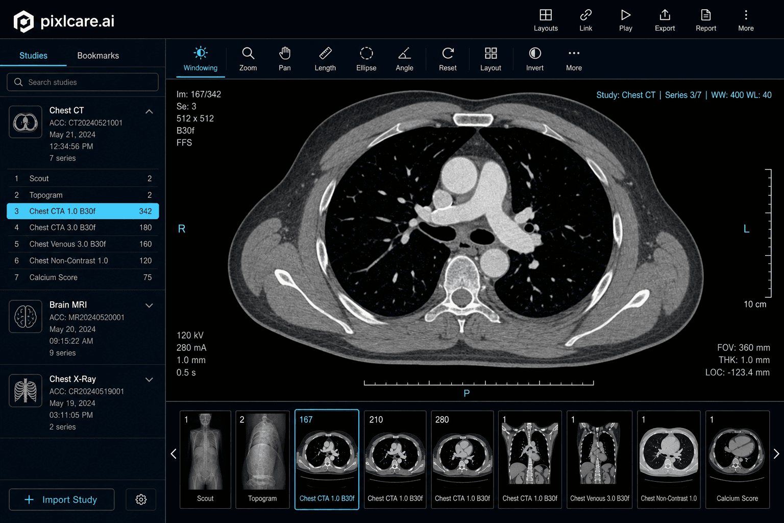 pixlcare.ai DICOM viewer showing chest CT with series navigation